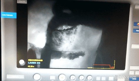 Fluorescence imaging