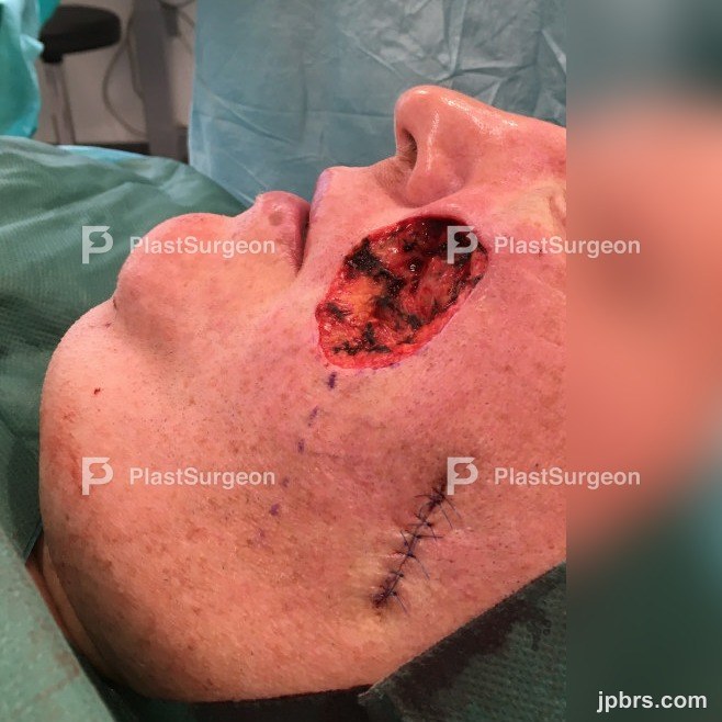 Pre-operative evaluation