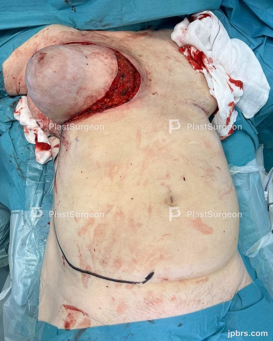 Pre-operative imaging