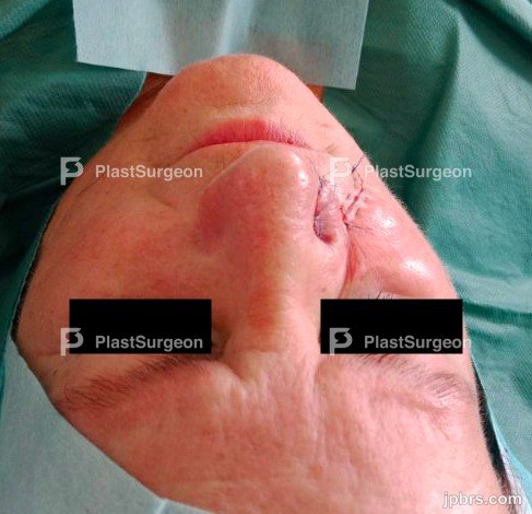 Anterior view